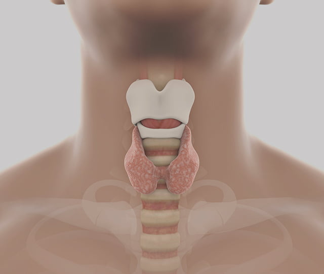 Hypothyroidism