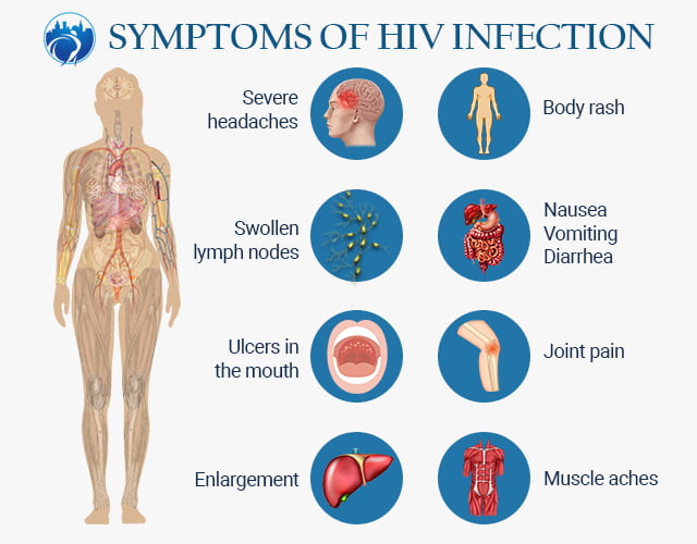 Symptoms of HIV infection